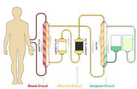 Water for Hemodialysis: commons