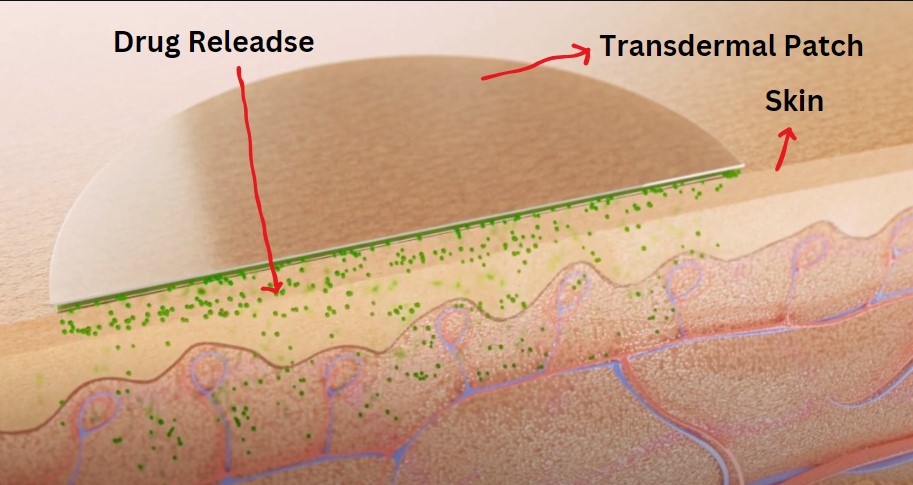 Transdermal Patches attached to skin
